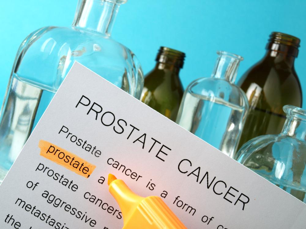 Prostate Cancer &#8211; Diagnosis, Treatment, and Risk Factors