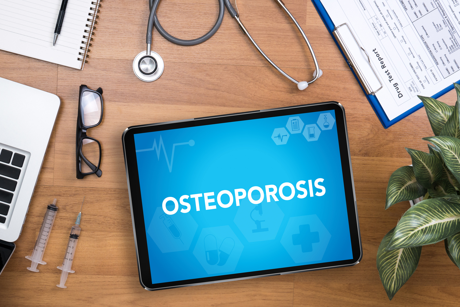 What to Do Now to Prevent Osteoporosis