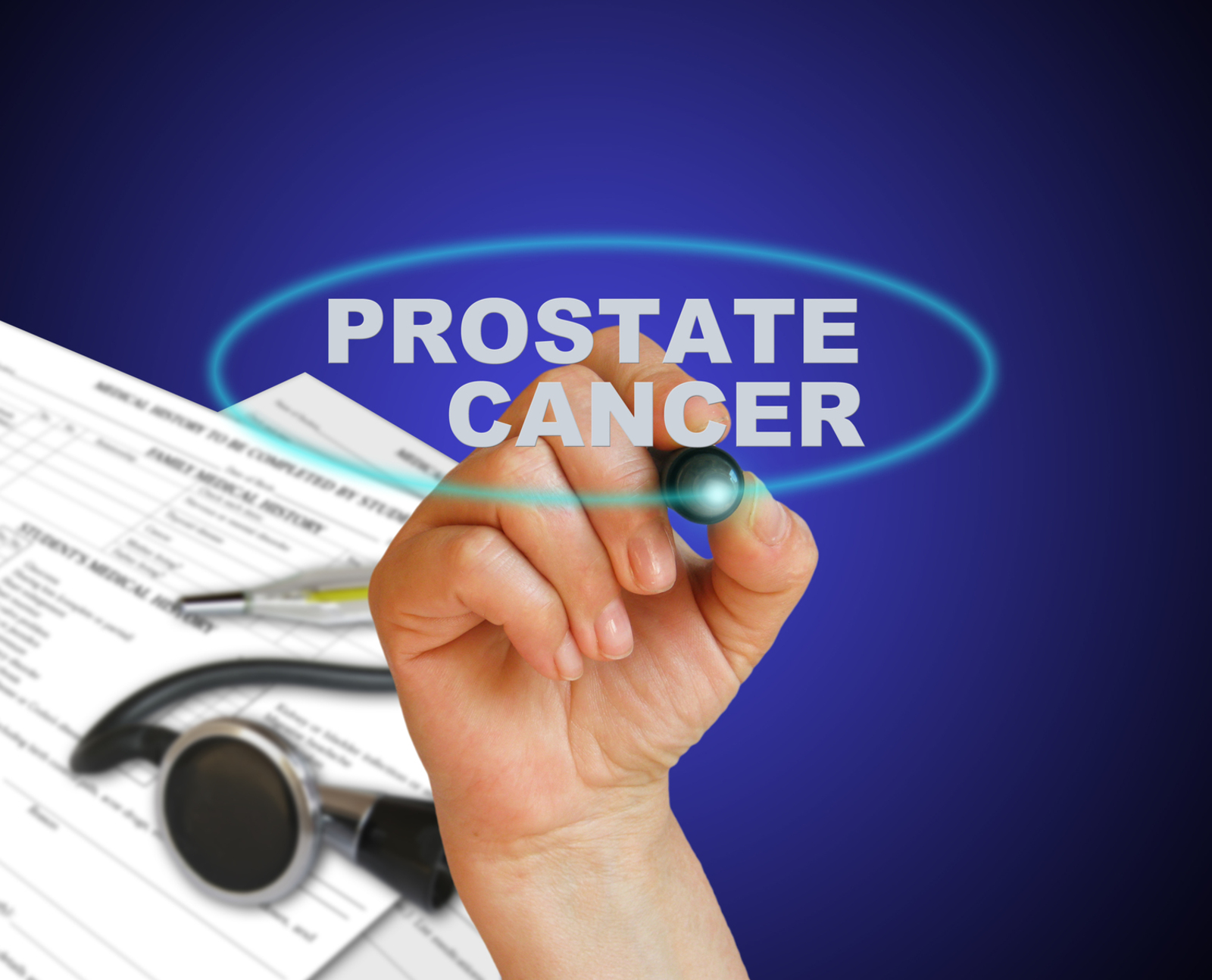 4 Early Symptoms of Prostate Cancer