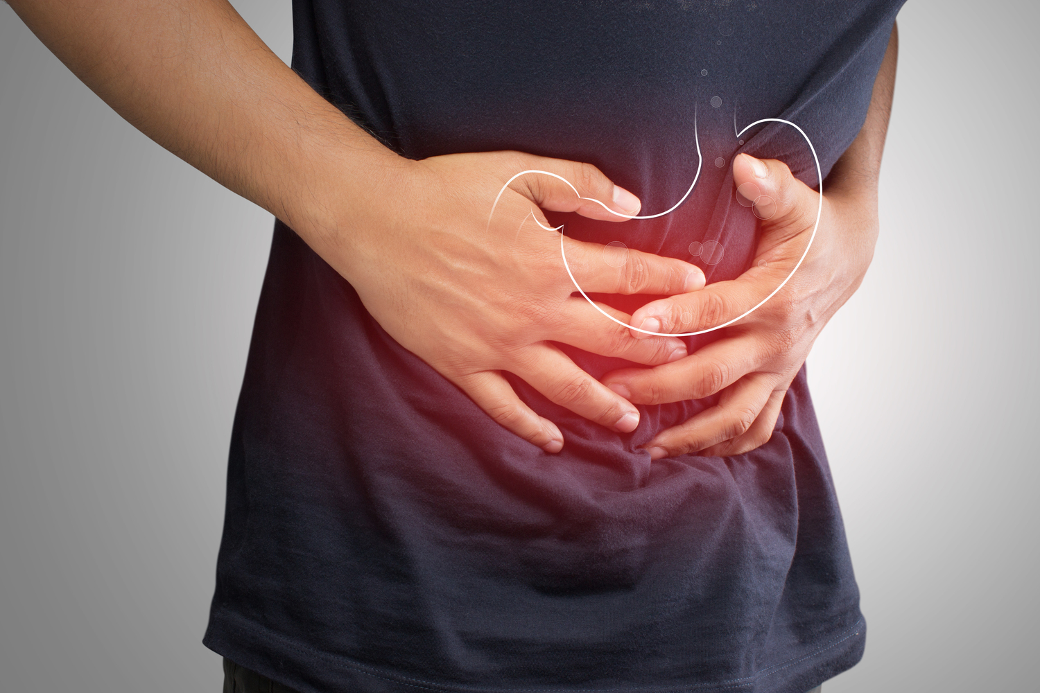 5 Common Early Symptoms and Causes of Gastric Cancer