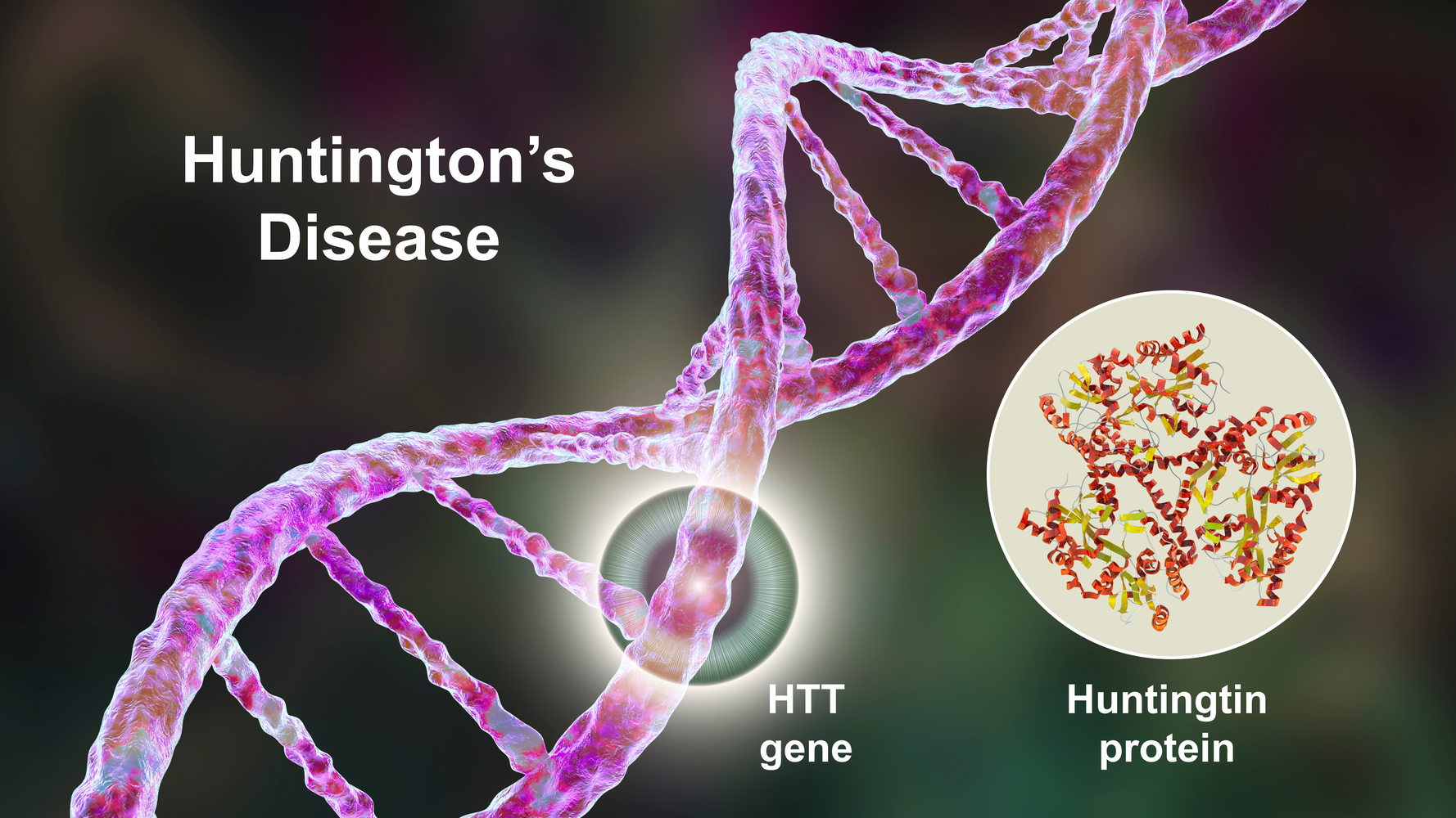 The Primary Cause Of Huntington&#8217;s Chorea