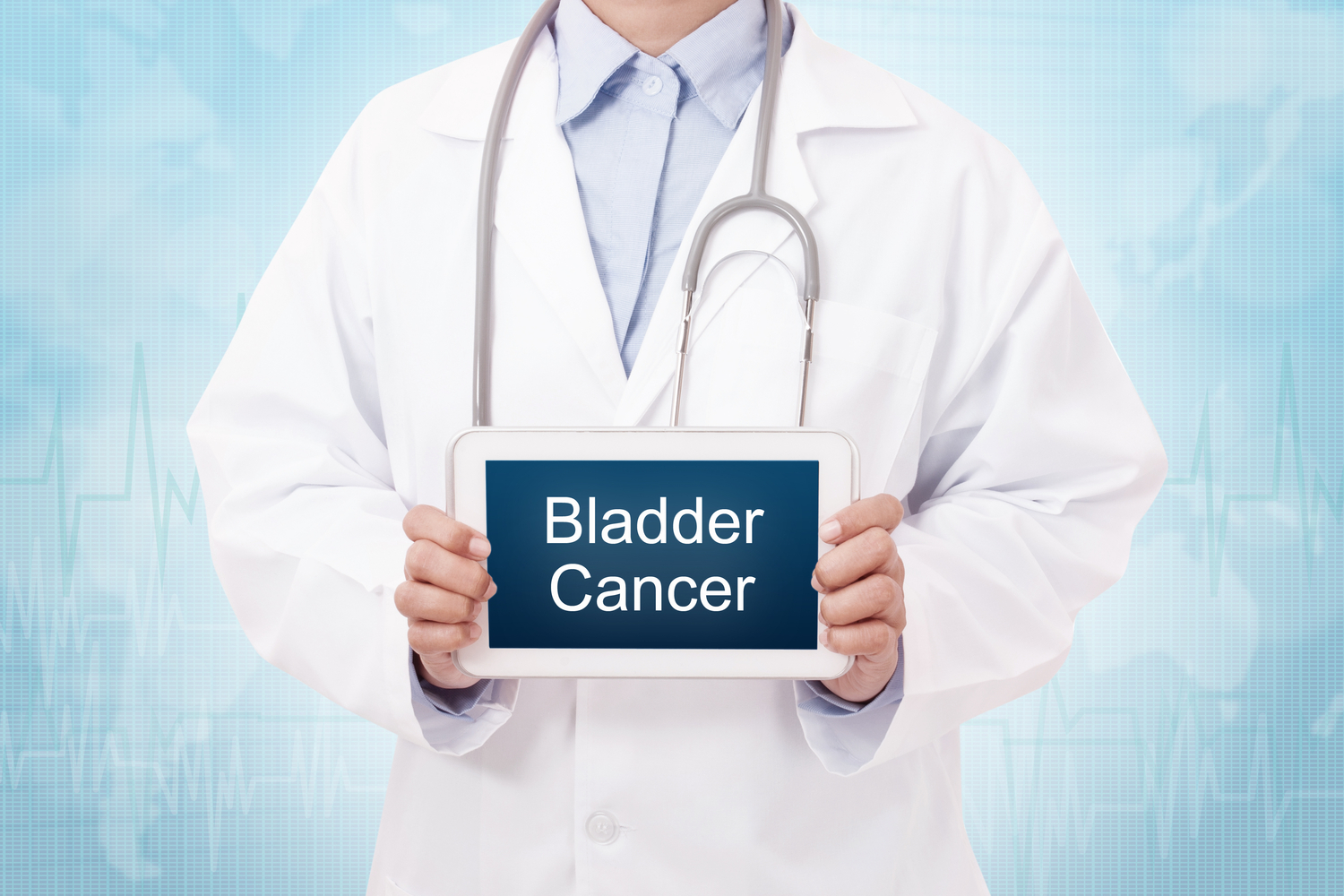 5 Early Warning Signs of Bladder Cancer